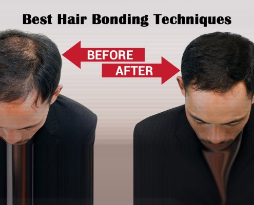 Hair-Bonding treatment