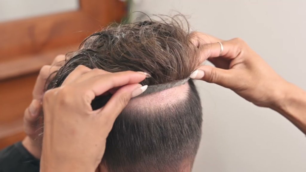 Hair Patch Clipping